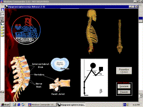 skeleton picture
